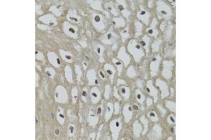 Immunohistochemistry of paraffin-embedded human esophagus using IL33 antibody (ABIN6290531) (40x lens). (IL-33 anticorps)
