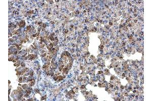 IHC-P Image Monoamine Oxidase B antibody [N2C3] detects Monoamine Oxidase B protein at cytoplasm on mouse lung by immunohistochemical analysis.