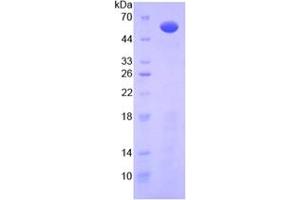 SDS-PAGE analysis of Mouse IL10Ra Protein. (IL-10RA Protéine)