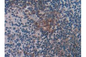 Detection of CD74 in Mouse Spleen Tissue using Polyclonal Antibody to Cluster Of Differentiation 74 (CD74)