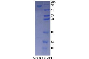 SDS-PAGE analysis of Rat ANKRD1 Protein. (ANKRD1 Protéine)