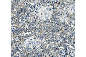 IHC analysis of PHEX using anti-PHEX antibody (ABIN7600072). (PHEX anticorps  (AA 145-718))