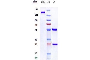 Anti- Human LAG3( Relatlimab) on SDS-PAGE under reducing (R) condition. (Recombinant LAG3 (Relatlimab Biosimilar) anticorps)