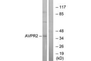 Western Blotting (WB) image for anti-Arginine Vasopressin Receptor 2 (AVPR2) (AA 72-121) antibody (ABIN2891101) (AVPR2 anticorps  (AA 72-121))