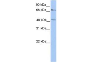 Western Blotting (WB) image for anti-Carbohydrate (Chondroitin 4) Sulfotransferase 13 (CHST13) antibody (ABIN2463257) (CHST13 anticorps)