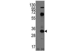 Western blot analysis of CD8 antibody and 293 cell lysate (2 ug/lane) either nontransfected (Lane 1) or transiently transfected with the CD8A gene (2).