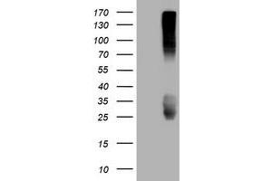 Image no. 3 for anti-CD99 (CD99) antibody (ABIN1497384) (CD99 anticorps)