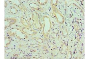 Immunohistochemistry of paraffin-embedded human kidney tissue using ABIN7151645 at dilution of 1:100 (SH3GLB1 anticorps  (AA 1-365))