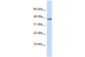 WB Suggested Anti-SPINK1 Antibody Titration:  0. (SPINK1 anticorps  (N-Term))