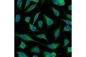 Immunofluorescent analysis of Caspase 9 staining in Hela cells.