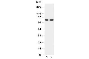 Western blot testing of FOXP1 antibody and Lane 1:  rat spleen