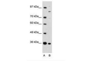 Image no. 1 for anti-Ankyrin Repeat and Zinc Finger Domain Containing 1 (ANKZF1) (AA 106-155) antibody (ABIN6735962) (ANKZF1 anticorps  (AA 106-155))
