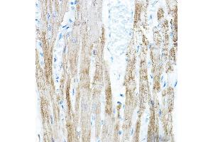 Immunohistochemistry of paraffin-embedded rat heart using PDK4 Rabbit pAb (ABIN6132477, ABIN6145396, ABIN6145397 and ABIN6217290) at dilution of 1:100 (40x lens).