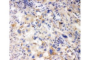 IHC analysis of APOL1 using anti-APOL1 antibody (ABIN7600725).