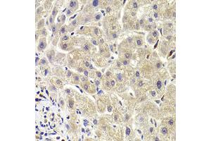Immunohistochemistry of paraffin-embedded human liver injury using AKT1S1 Antibody (ABIN5973672) at dilution of 1/100 (40x lens). (PRAS40 anticorps)