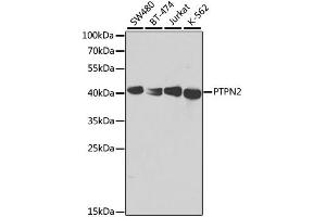 Western blot analysis of extracts of various cell lines, using PTPN2 antibody. (PTPN2 anticorps)
