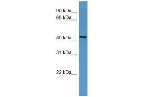 WB Suggested Anti-B4galt5 Antibody Titration: 0.