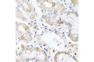 Immunohistochemistry of paraffin-embedded human stomach using RPL36 antibody.