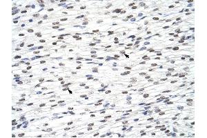 HNRPLL antibody was used for immunohistochemistry at a concentration of 4-8 ug/ml to stain Myocardial cells (arrows) in Human Heart.