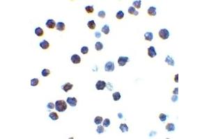 Immunohistochemistry (IHC) image for anti-BCL2-Antagonist/killer 1 (BAK1) (N-Term) antibody (ABIN1031258) (BAK1 anticorps  (N-Term))