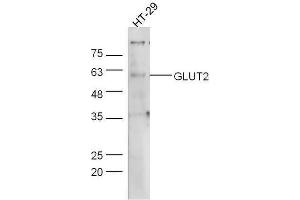 Human HT-29 lysates probed with Rabbit Anti-Glut2 Polyclonal Antibody, Unconjugated  at 1:5000 for 90 min at 37˚C.