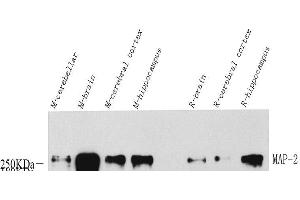 Western Blot analysis of various samples using MAP2 Polyclonal Antibody at dilution of 1:1000. (MAP2 anticorps)
