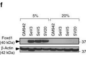 MICU1 is transcriptionally regulated by Foxd1 under hypoxia. (FOXD1 anticorps  (C-Term))