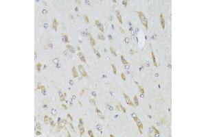 Immunohistochemistry of paraffin-embedded mouse brain using RPL13 Antibody.