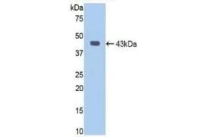 Detection of Recombinant JAG1, Human using Polyclonal Antibody to Jagged 1 (JAG1) (JAG1 anticorps  (AA 470-834))