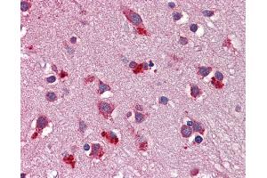 Immunohistochemistry (IHC) image for anti-Wingless-Type MMTV Integration Site Family, Member 7B (WNT7B) (Middle Region) antibody (ABIN2776732)