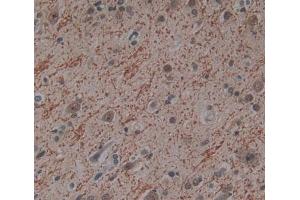 Used in DAB staining on fromalin fixed paraffin- embedded Kidney tissue (PITPNB anticorps  (AA 2-271))