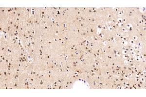 Detection of FGF2 in Rat Cerebrum Tissue using Polyclonal Antibody to Fibroblast Growth Factor 2, Basic (FGF2) (FGF2 anticorps  (AA 159-288))