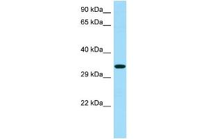 WB Suggested Anti-RBFA Antibody Titration: 1. (RBFA anticorps  (C-Term))