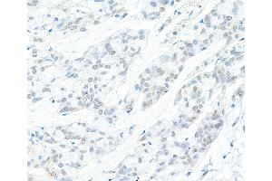Immunohistochemistry (IHC) image for anti-Cyclin C (CCNC) (AA 233-283) antibody (ABIN7453580)