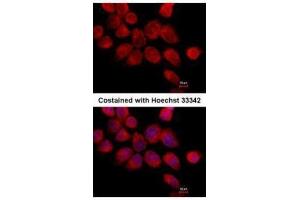 ICC/IF Image Immunofluorescence analysis of paraformaldehyde-fixed A431, using Transketolase, antibody at 1:500 dilution. (TKT anticorps)