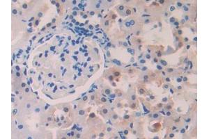 Used in DAB staining on fromalin fixed paraffin- embedded stomach tissue (PIGR anticorps  (AA 343-447))