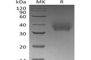 Western Blotting (WB) image for Interleukin 21 Receptor (IL21R) protein (His tag) (ABIN7320813)