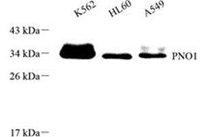 Western blot analysis of PNO1 (ABIN7074991),at dilution of 1: 1000 (PNO1 anticorps)