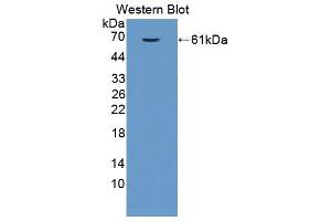 Western blot analysis of the recombinant protein. (EPRS anticorps  (AA 1007-1512))