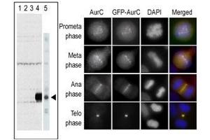 The anti-Aurora C Pab (ABIN1882164 and ABIN2841162) is used in Western blot to detect Aurora C in lysates of 293 cells expressing Flag tag (lane 1), Flag-tagged Aurora A (lane 2), Flag-tagged Aurora B (lane 3), Flag-tagged Aurora C (lane 4), and in  cell lysate.