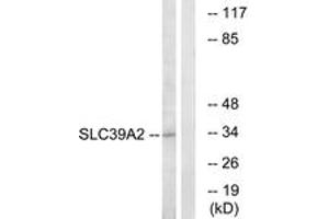 Western blot analysis of extracts from Jurkat cells, using SLC39A2 Antibody. (ZIP2 anticorps  (AA 11-60))