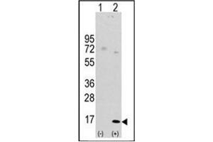 Western blot analysis of LC3 (APG8a) (arrow) using Autophagy LC3 Antibody (APG8a) (D106) Cat. (MAP1LC3A anticorps  (AA 92-121))
