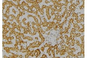 ABIN6276621 at 1/100 staining Mouse liver tissue by IHC-P. (ITPA anticorps  (Internal Region))