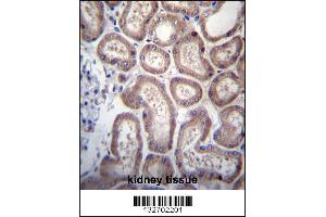 SP140 Antibody immunohistochemistry analysis in formalin fixed and paraffin embedded human kidney tissue followed by peroxidase conjugation of the secondary antibody and DAB staining. (SP140 anticorps  (AA 272-301))