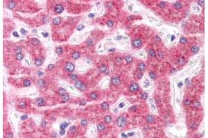 Anti-ENPP3 antibody  ABIN1048561 IHC staining of human liver.