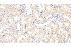 anti-Oxidized Low Density Lipoprotein (Lectin-Like) Receptor 1 (OLR1) (AA 81-273) antibody