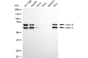 Western blotting analysis using Lamin A/C antibody (ABIN7799228).