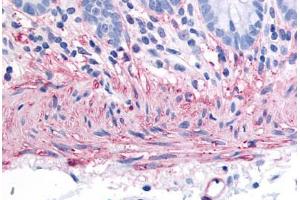 Human Colon, Smooth Muscle (formalin-fixed, paraffin-embedded) stained with TACR2 antibody ABIN213476 at 40 ug/ml followed by biotinylated goat anti-rabbit IgG secondary antibody ABIN481713, alkaline phosphatase-streptavidin and chromogen.