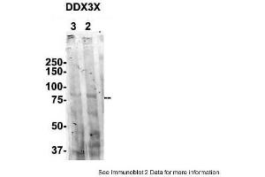 Sample Type: 1. (DDX3X anticorps  (N-Term))
