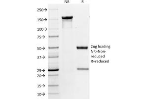 SDS-PAGE Analysis Purified CD86 Mouse Monoclonal Antibody (BU63).
